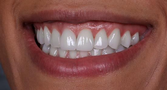 Contorno Cosmético Campinas